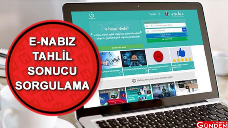e- Nabız devrede nabız testi